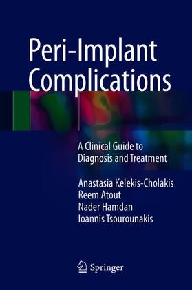 Kelekis-Cholakis / Tsourounakis / Atout |  Peri-Implant Complications | Buch |  Sack Fachmedien