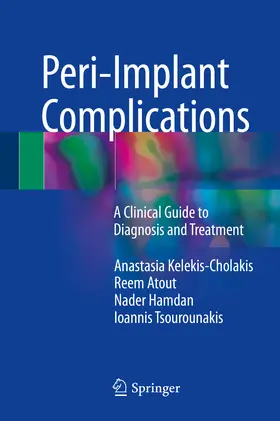 Kelekis-Cholakis / Atout / Hamdan |  Peri-Implant Complications | eBook | Sack Fachmedien