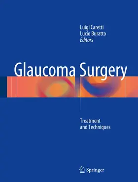 Buratto / Caretti |  Glaucoma Surgery | Buch |  Sack Fachmedien