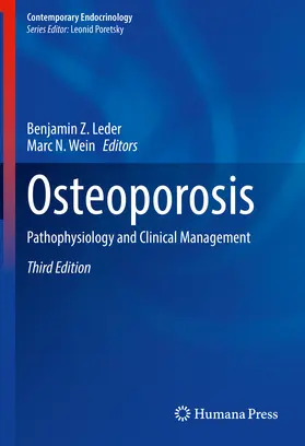 Leder / Wein |  Osteoporosis | eBook | Sack Fachmedien