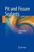 Bekes |  Pit and Fissure Sealants | Buch |  Sack Fachmedien