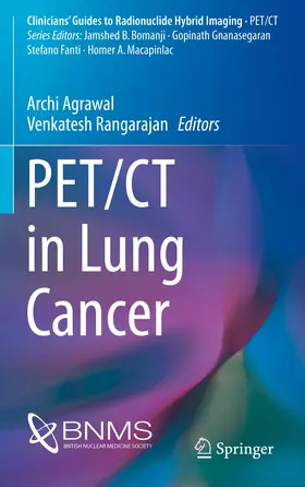 Agrawal / Rangarajan |  PET/CT in Lung Cancer | eBook | Sack Fachmedien