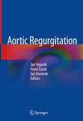 Vojacek / Zacek / Dominik |  Aortic Regurgitation | eBook | Sack Fachmedien