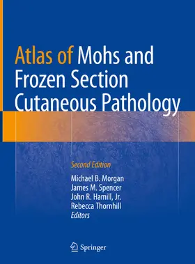Morgan / Spencer / Hamill, Jr. | Atlas of Mohs and Frozen Section Cutaneous Pathology | E-Book | www.sack.de