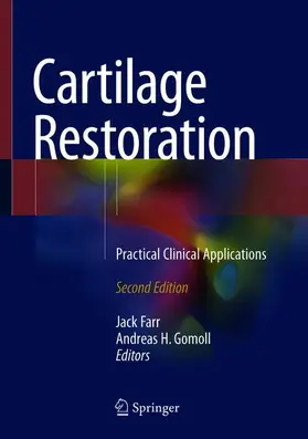 Gomoll / Farr | Cartilage Restoration | Buch | 978-3-319-77151-9 | www.sack.de