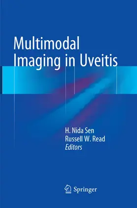 Sen / Read |  Multimodal Imaging in Uveitis | Buch |  Sack Fachmedien