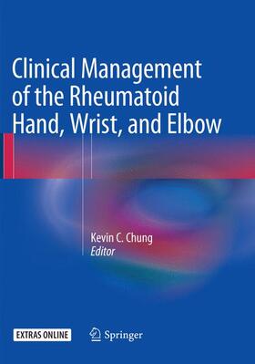 Chung | Clinical Management of the Rheumatoid Hand, Wrist, and Elbow | Buch | 978-3-319-79991-9 | sack.de
