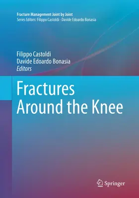 Castoldi / Bonasia |  Fractures Around the Knee | Buch |  Sack Fachmedien