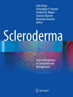 Varga / Denton / Wigley |  Scleroderma | Buch |  Sack Fachmedien