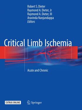 Dieter / Nanjundappa / Dieter, Jr | Critical Limb Ischemia | Buch | 978-3-319-81171-0 | sack.de