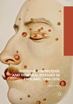 Hanley |  Medicine, Knowledge and Venereal Diseases in England, 1886-1916 | Buch |  Sack Fachmedien