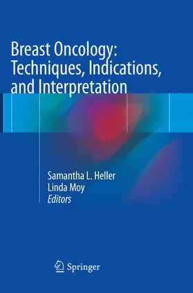 Moy / Heller |  Breast Oncology: Techniques, Indications, and Interpretation | Buch |  Sack Fachmedien
