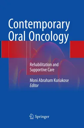 Kuriakose | Contemporary Oral Oncology | Buch | 978-3-319-82926-5 | www.sack.de