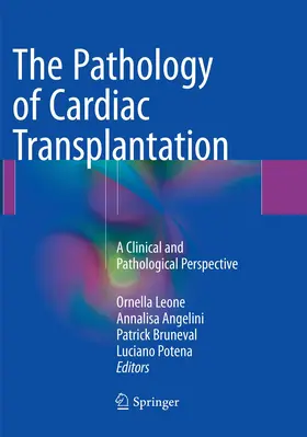 Leone / Potena / Angelini |  The Pathology of Cardiac Transplantation | Buch |  Sack Fachmedien