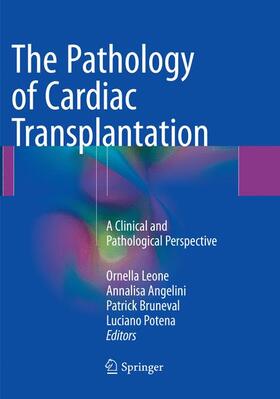 Leone / Potena / Angelini | The Pathology of Cardiac Transplantation | Buch | 978-3-319-83507-5 | sack.de