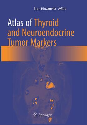 Giovanella | Atlas of Thyroid and Neuroendocrine Tumor Markers | Buch | 978-3-319-87330-5 | sack.de
