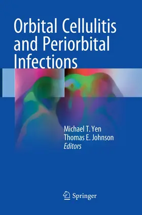 Yen / Johnson |  Orbital Cellulitis and Periorbital Infections | Buch |  Sack Fachmedien