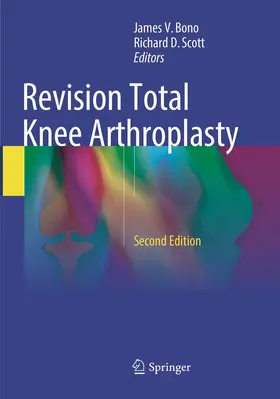 Scott / Bono |  Revision Total Knee Arthroplasty | Buch |  Sack Fachmedien