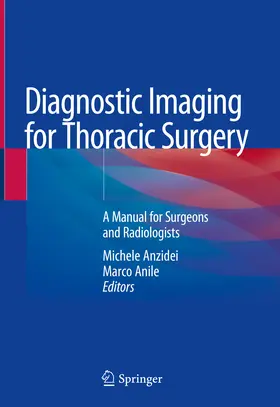 Anzidei / Anile |  Diagnostic Imaging for Thoracic Surgery | eBook | Sack Fachmedien