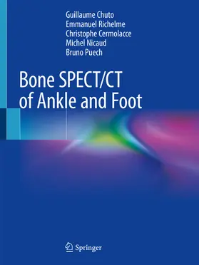 Chuto / Richelme / Cermolacce |  Bone SPECT/CT of Ankle and Foot | eBook | Sack Fachmedien