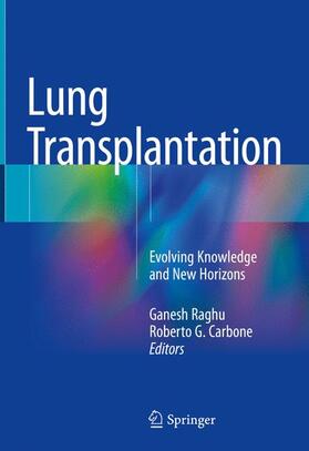 Carbone / Raghu | Lung Transplantation | Buch | 978-3-319-91182-3 | sack.de