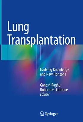 Raghu / Carbone | Lung Transplantation | E-Book | sack.de