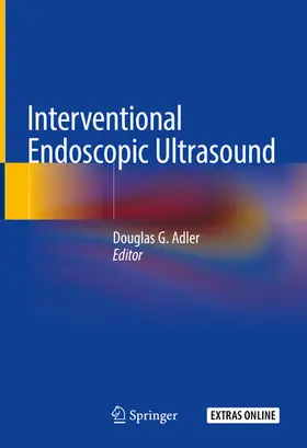 Adler / MD / FACG |  Interventional Endoscopic Ultrasound | eBook | Sack Fachmedien