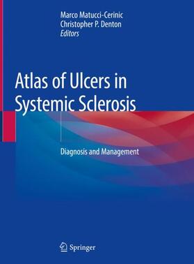 Denton / Matucci-Cerinic | Atlas of Ulcers in Systemic Sclerosis | Buch | 978-3-319-98475-9 | sack.de