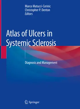 Matucci-Cerinic / Denton | Atlas of Ulcers in Systemic Sclerosis | E-Book | sack.de