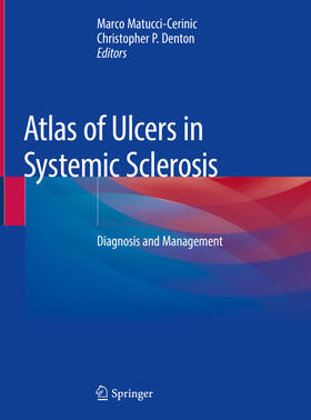 Matucci-Cerinic / Denton | Atlas of Ulcers in Systemic Sclerosis | E-Book | sack.de