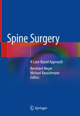 Meyer / Rauschmann |  Spine Surgery | eBook | Sack Fachmedien