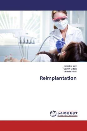 Jain / Gupta / Nikhil |  Reimplantation | Buch |  Sack Fachmedien