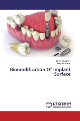 Jahan / Kaushik | Biomodification Of Implant Surface | Buch | 978-3-330-01493-0 | sack.de