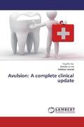 Kumar / Verma / Kaushal |  Avulsion: A complete clinical update | Buch |  Sack Fachmedien