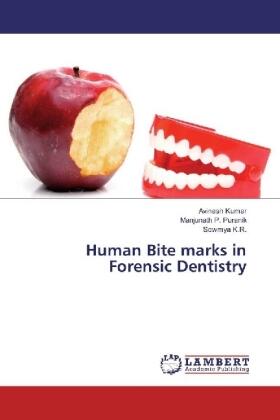 Kumar / P. Puranik / K. R. |  Human Bite marks in Forensic Dentistry | Buch |  Sack Fachmedien