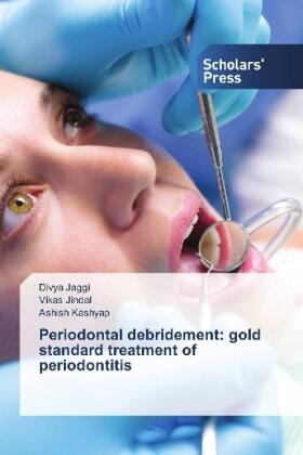 Jaggi / Jindal / Kashyap |  Periodontal debridement: gold standard treatment of periodontitis | Buch |  Sack Fachmedien