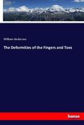 Anderson |  The Deformities of the Fingers and Toes | Buch |  Sack Fachmedien