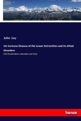 Gay |  On Varicose Disease of the Lower Extremities and Its Allied Disorders | Buch |  Sack Fachmedien