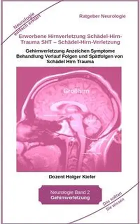 Kiefer |  Erworbene Hirnverletzung Schädel-Hirn-Trauma SHT - Schädel-Hirn-Verletzung - Rehabilitation - für Patienten, Angehörige, medizinisches Personal | Buch |  Sack Fachmedien