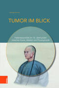 Kamola |  Kamola, J: Tumor im Blick | Buch |  Sack Fachmedien