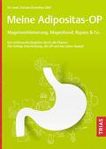 Witt |  Meine Adipositas-OP. Magenverkleinerung, Magenband, Bypass & Co. | eBook | Sack Fachmedien
