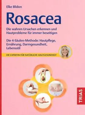 Blidon |  Rosacea | eBook | Sack Fachmedien