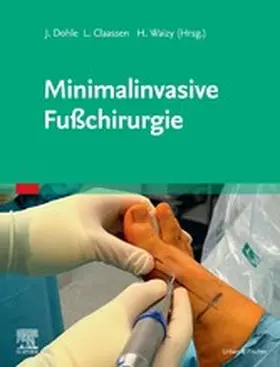 Dohle / Claaßen / Waizy |  Minimalinvasive Fußchirurgie | eBook | Sack Fachmedien