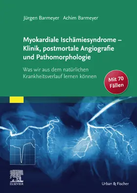 Barmeyer |  Die myokardialen Ischämiesyndrome - Klinik und postmortale Pathomorphologie | eBook | Sack Fachmedien