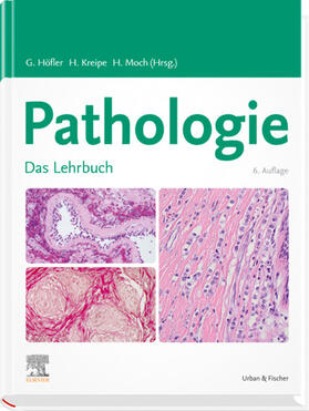 Böcker / Denk / Moch | Lehrbuch Pathologie | E-Book | sack.de