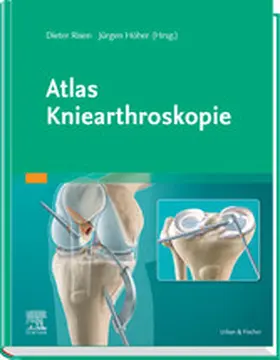 Rixen / Höher |  Atlas Kniearthroskopie | eBook | Sack Fachmedien