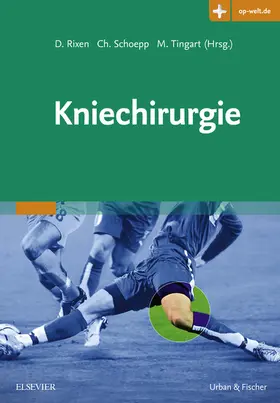 Rixen / Schoepp / Tingart |  Kniechirurgie | eBook | Sack Fachmedien