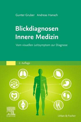 Gruber / Hansch | Blickdiagnosen Innere Medizin | Buch | 978-3-437-21077-8 | sack.de