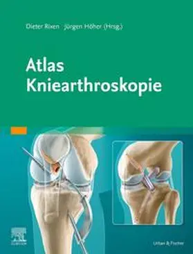 Höher / Rixen |  Atlas Kniearthroskopie | Buch |  Sack Fachmedien