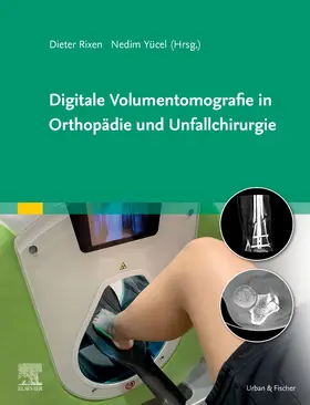 Rixen / Yücel | Digitale Volumentomografie in Orthopädie und Unfallchirurgie | Buch | 978-3-437-23003-5 | sack.de